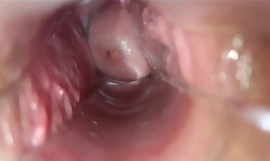 vaginal go down retreat from